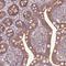 Zinc Finger Protein 57 antibody, NBP1-94138, Novus Biologicals, Immunohistochemistry paraffin image 