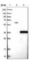Phytanoyl-CoA Dioxygenase Domain Containing 1 antibody, NBP1-81187, Novus Biologicals, Western Blot image 