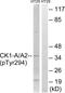 Casein Kinase 1 Alpha 1 antibody, AP55752PU-N, Origene, Western Blot image 