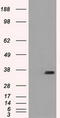 CD32a antibody, LS-C114749, Lifespan Biosciences, Western Blot image 