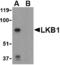 Serine/Threonine Kinase 11 antibody, TA306371, Origene, Western Blot image 