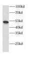 CNR1 antibody, FNab01244, FineTest, Western Blot image 