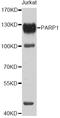 Poly(ADP-Ribose) Polymerase 1 antibody, A0010, ABclonal Technology, Western Blot image 
