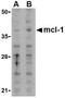 MCL1 Apoptosis Regulator, BCL2 Family Member antibody, TA306208, Origene, Western Blot image 