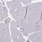 Calcium Sensing Receptor antibody, HPA050335, Atlas Antibodies, Immunohistochemistry paraffin image 