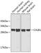 Calbindin 1 antibody, 19-154, ProSci, Western Blot image 