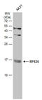 Ribosomal Protein S25 antibody, GTX101526, GeneTex, Western Blot image 