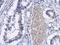 Eukaryotic Translation Initiation Factor 5A2 antibody, NBP2-16312, Novus Biologicals, Immunohistochemistry paraffin image 
