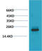Heat Shock Protein Family B (Small) Member 8 antibody, STJ97543, St John