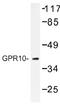 Prolactin-releasing peptide receptor antibody, AP01336PU-N, Origene, Western Blot image 