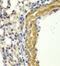 Protein Kinase CGMP-Dependent 1 antibody, FNab06786, FineTest, Immunohistochemistry paraffin image 