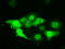 Pim-2 Proto-Oncogene, Serine/Threonine Kinase antibody, TA501070, Origene, Immunofluorescence image 