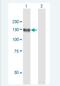 Leucyl And Cystinyl Aminopeptidase antibody, H00004012-B01P-50ug, Novus Biologicals, Western Blot image 