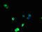 Mitogen-activated protein kinase kinase kinase 8 antibody, A62938-100, Epigentek, Immunofluorescence image 