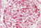 Zinc finger FYVE domain-containing protein 21 antibody, MBS248313, MyBioSource, Immunohistochemistry frozen image 