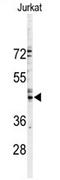 Gap Junction Protein Alpha 3 antibody, AP11570PU-N, Origene, Western Blot image 