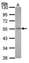 NADH:Ubiquinone Oxidoreductase Core Subunit V1 antibody, orb70000, Biorbyt, Western Blot image 
