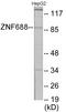 Zinc Finger Protein 785 antibody, EKC1885, Boster Biological Technology, Western Blot image 