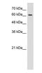 Cholinergic Receptor Nicotinic Epsilon Subunit antibody, PA1-24272, Invitrogen Antibodies, Western Blot image 