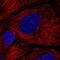 HPS4 Biogenesis Of Lysosomal Organelles Complex 3 Subunit 2 antibody, PA5-62152, Invitrogen Antibodies, Immunofluorescence image 