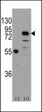 Cadherin 9 antibody, LS-B8996, Lifespan Biosciences, Western Blot image 