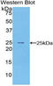 PMP-22 antibody, LS-C295806, Lifespan Biosciences, Western Blot image 