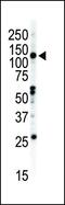 EPH Receptor B2 antibody, PA1-30297, Invitrogen Antibodies, Western Blot image 