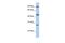Centromere Protein I antibody, PA5-44217, Invitrogen Antibodies, Western Blot image 
