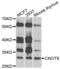 CCR4-NOT transcription complex subunit 8 antibody, PA5-76334, Invitrogen Antibodies, Western Blot image 