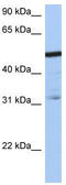 ZFP14 Zinc Finger Protein antibody, TA339743, Origene, Western Blot image 