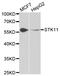 Serine/Threonine Kinase 11 antibody, orb48550, Biorbyt, Western Blot image 
