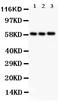 Solute carrier family 2, facilitated glucose transporter member 9 antibody, PA2166, Boster Biological Technology, Western Blot image 