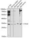 Cytotoxic T-Lymphocyte Associated Protein 4 antibody, GTX32542, GeneTex, Western Blot image 