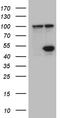 Histone deacetylase 8 antibody, TA809651, Origene, Western Blot image 