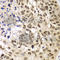 Ubiquitin-conjugating enzyme E2 B antibody, A6315, ABclonal Technology, Immunohistochemistry paraffin image 