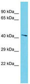 NADH:Ubiquinone Oxidoreductase Complex Assembly Factor 7 antibody, TA330684, Origene, Western Blot image 