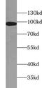 Villin 1 antibody, FNab09407, FineTest, Western Blot image 