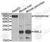 Mannose Binding Lectin 2 antibody, A5825, ABclonal Technology, Western Blot image 