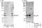 E3 ubiquitin-protein ligase AMFR antibody, A302-889A, Bethyl Labs, Western Blot image 