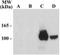 Glutamate Ionotropic Receptor NMDA Type Subunit 1 antibody, NB300-117, Novus Biologicals, Western Blot image 