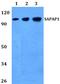 DLG Associated Protein 1 antibody, A08230, Boster Biological Technology, Western Blot image 