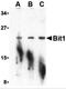 Peptidyl-TRNA Hydrolase 2 antibody, 3603, ProSci, Western Blot image 
