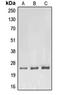 Ras Homolog Family Member F, Filopodia Associated antibody, orb215571, Biorbyt, Western Blot image 