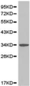 GIPC PDZ Domain Containing Family Member 2 antibody, TA322309, Origene, Western Blot image 