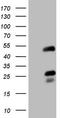 Nuclear receptor subfamily 2 group F member 6 antibody, TA806769S, Origene, Western Blot image 