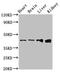 RUNX Family Transcription Factor 3 antibody, LS-C679380, Lifespan Biosciences, Western Blot image 