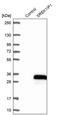SREK1 Interacting Protein 1 antibody, PA5-61066, Invitrogen Antibodies, Western Blot image 