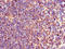 TXK Tyrosine Kinase antibody, orb53071, Biorbyt, Immunohistochemistry paraffin image 