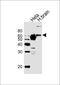 Glutaminase antibody, MBS9202061, MyBioSource, Western Blot image 