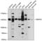Diaphanous Related Formin 2 antibody, GTX64810, GeneTex, Western Blot image 